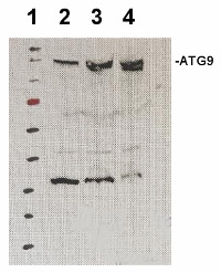 ATG9 | Autophagy-related protein 9 (N-terminal) in the group Antibodies Plant/Algal  / Arabidopsis thaliana  at Agrisera AB (Antibodies for research) (AS16 4071)
